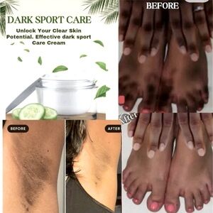 Dark Spot Remover 2oz